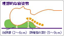 理想的な寝姿勢の図